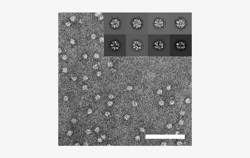 Bild - Aaa Atpases Negative Staining, transparent png #4107303