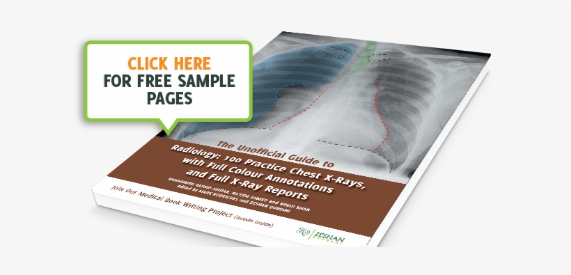 Unofficial Guide To Radiology - Radiology, transparent png #4108409