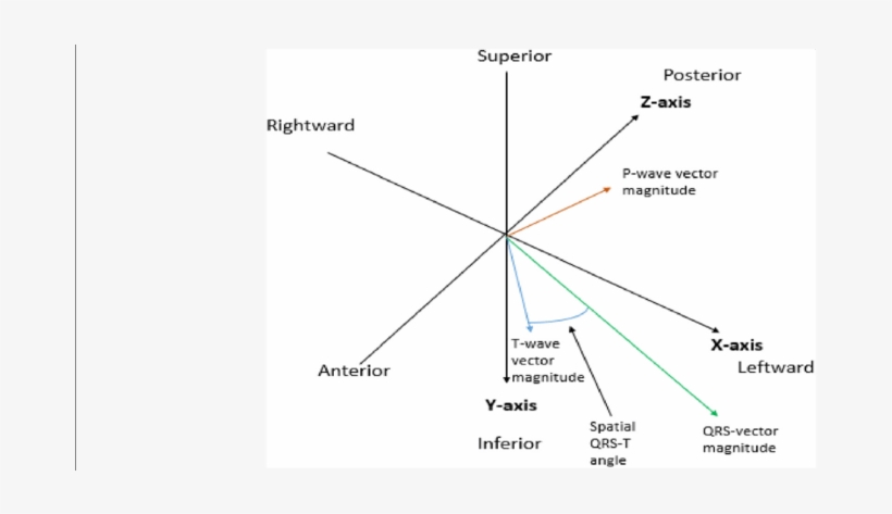 Example Of Determining The P Wave Vector Magnitude - Diagram, transparent png #4117391