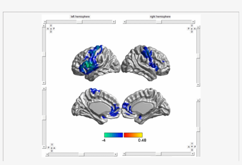 0 Software Was Used To Visualize The Anatomical Distribution - .org, transparent png #4157874