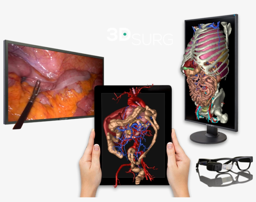 3d Technology Applied To Surgery - Surgery, transparent png #4157878