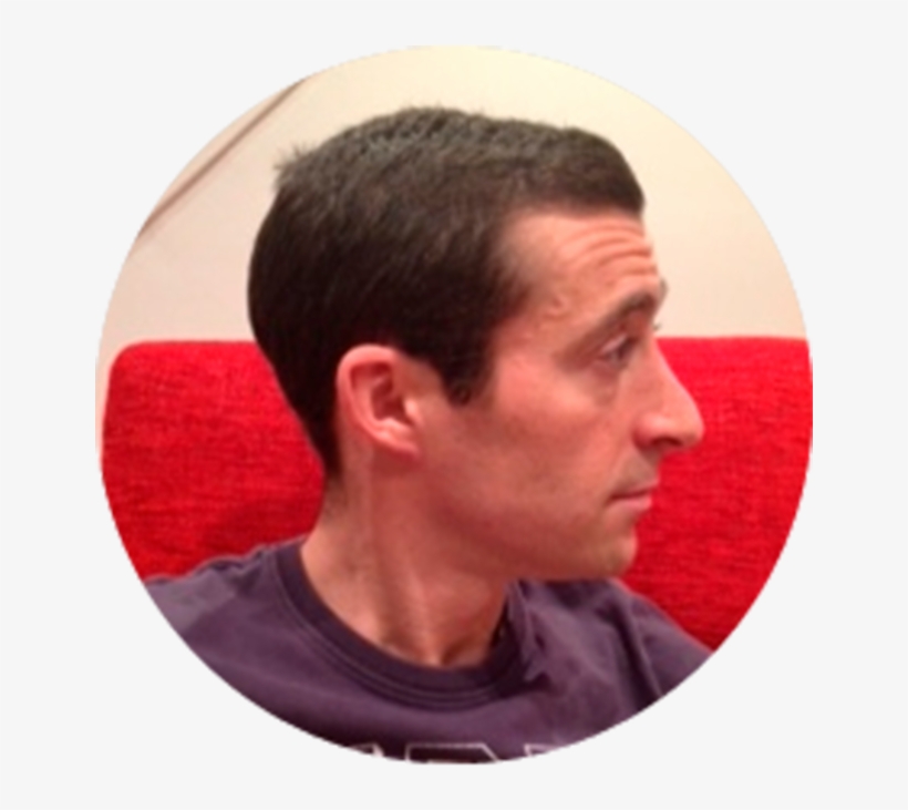 Anthony Anthony Father Of A Girl With Arthritis - Child, transparent png #4184896