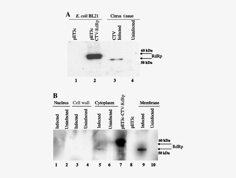 In Vivo Expression Analysis Of The Rna Dependent Rna - Number, transparent png #4187783