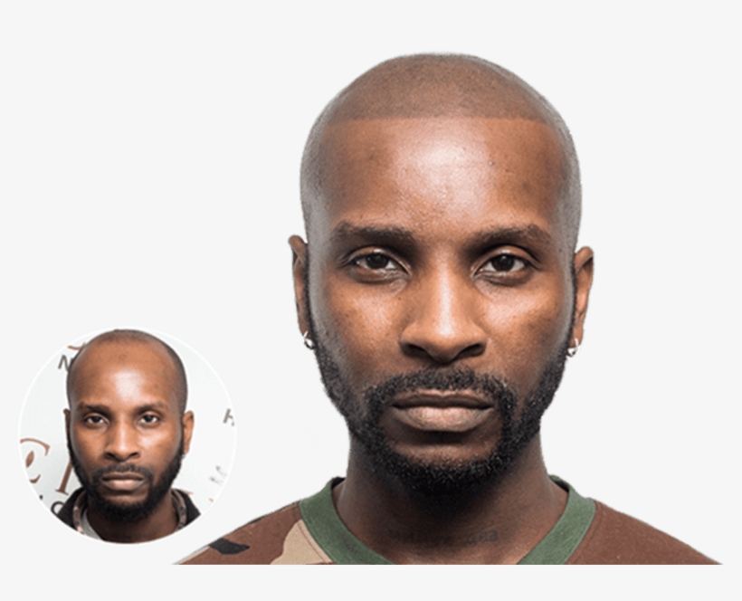 When I Looked In The Mirror After My Msp I Was So Amazed - Vinci Hair Clinic, transparent png #4263675