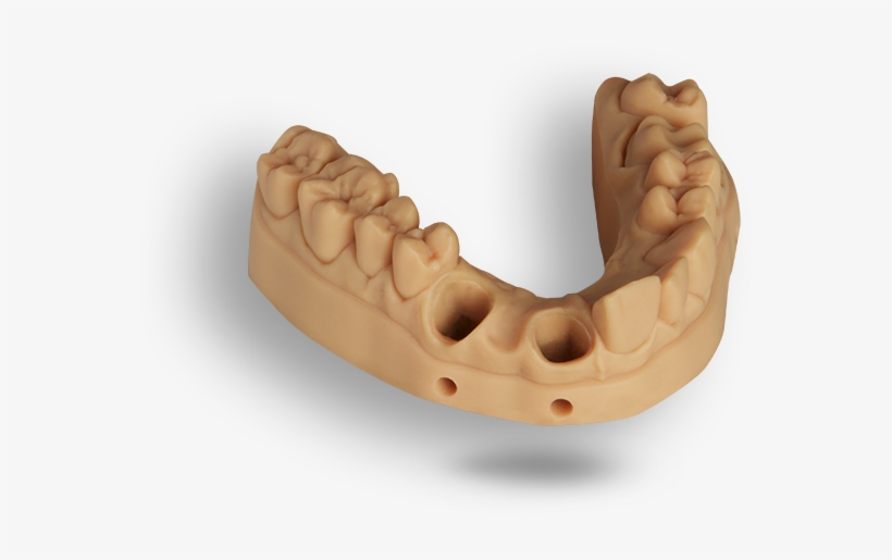 3d Printing Is The Catalyst For Digital Dentistry - Dental Models 3d Printed, transparent png #4275886