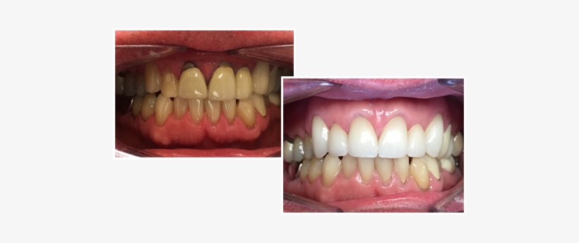 Here At 3d Dental Laboratories We Offer Only The Highest - Tongue, transparent png #4275928