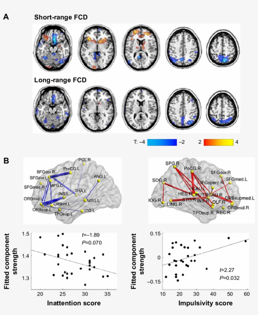 Disturbed Connectivity In Adhd - Notes Disturbed, transparent png #4289520
