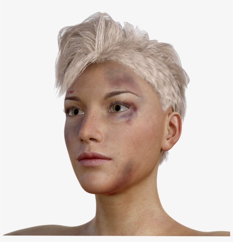My Heart Raced And I Wanted To Intervene - Bruise, transparent png #4312440