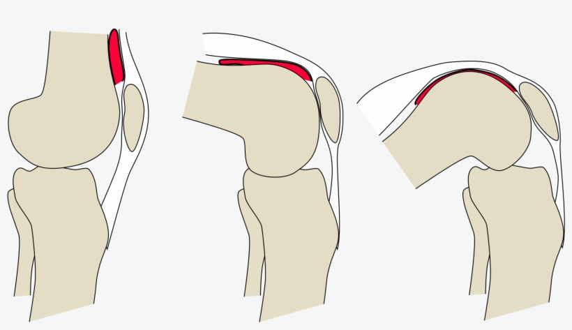 Open - Articularis Genu Muscle Knee, transparent png #4330550