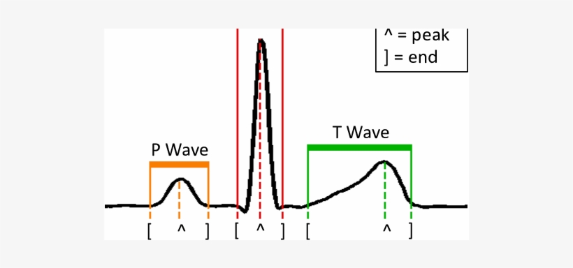 Delineated Normal Heartbeat [25] - Methadone, transparent png #4348161