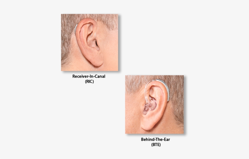 Of Hearing Loss - Diagram, transparent png #4361008