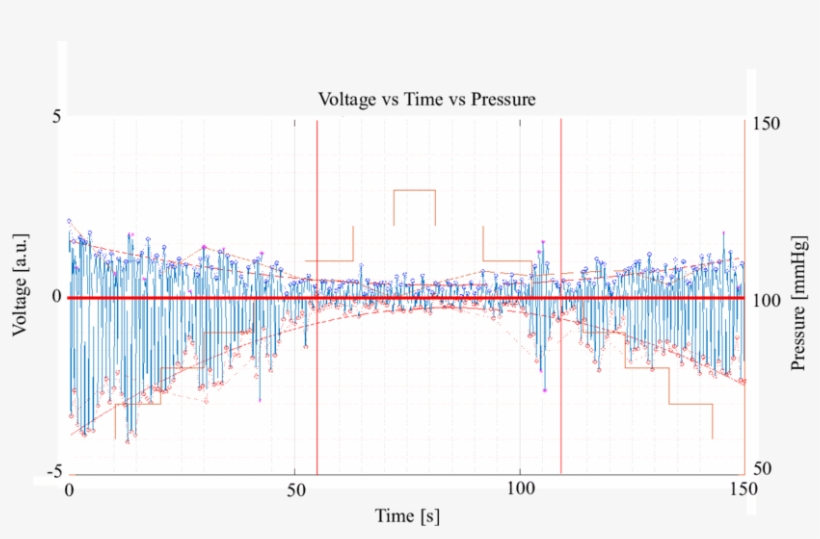 Green Light Processed With Matlab From An Oeps Signal - Diagram, transparent png #4373987
