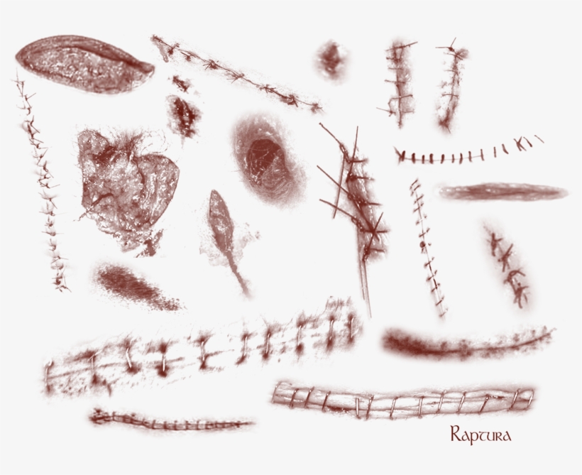 Wounds And Stitches By Raptura Stitches Png - Stitches, transparent png #4375211