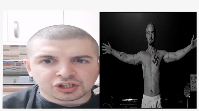Bald Gore Omegalul - Hair Loss, transparent png #4393110