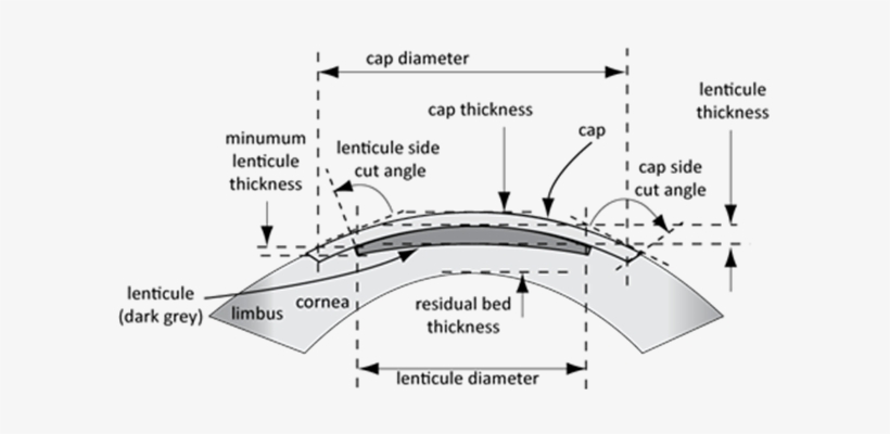 At Present This Requires A Curved Suction Cup Placed - Diagram, transparent png #4394601
