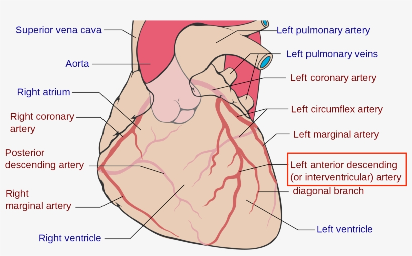 What Is A Widow-maker Kevin Smith's Scary Symptoms - Coronary Arteries, transparent png #4398200