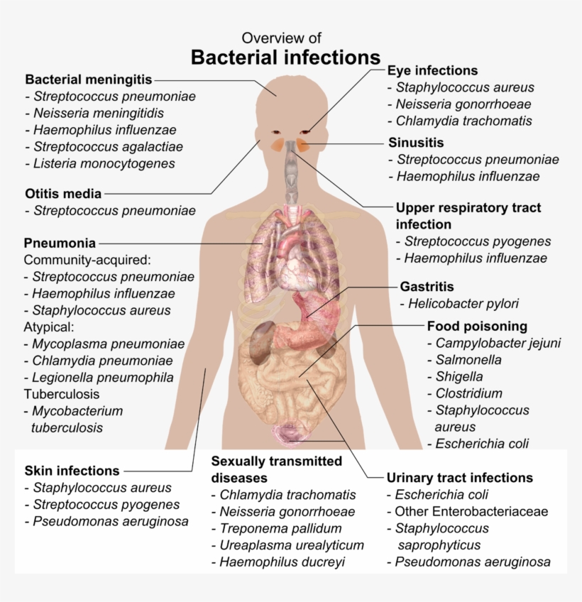 Bacterial Infections And Involved Species - Overview Of Bacterial Infections, transparent png #446728