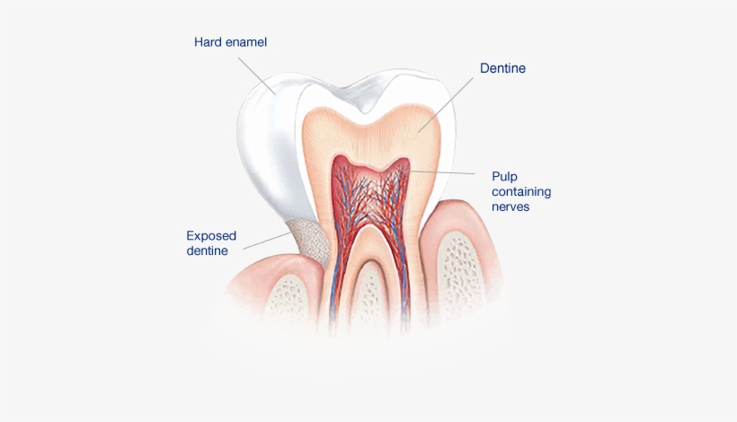 What Causes Sensitive Teeth - 牙 本质, transparent png #4413980