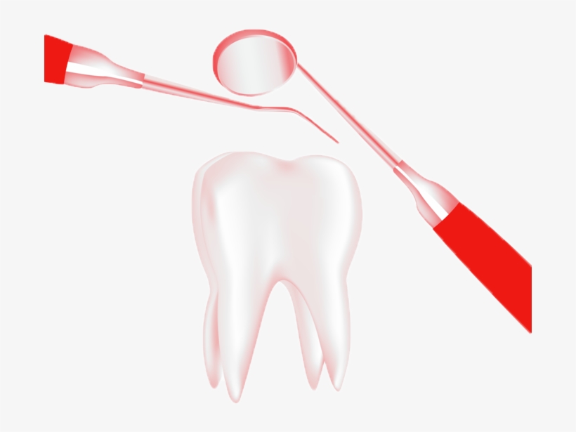 Tooth With Dental Equipment - Carmine, transparent png #4447617