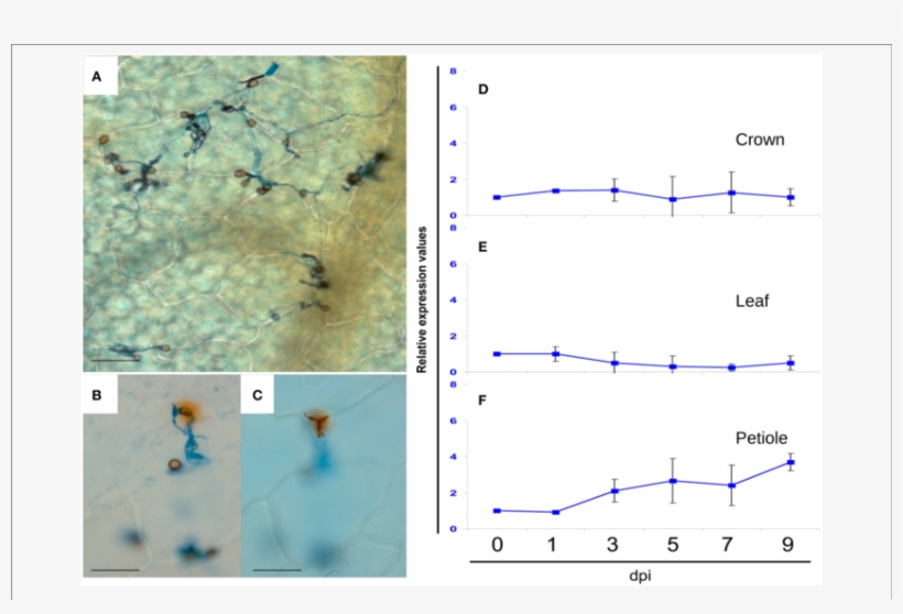 Light Microscopic Analysis Of Dab Stained Preparations - Colletotrichum Acutatum Secreted Protein, transparent png #4489447