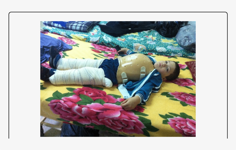 Equipment-two Plaster Splint And A Garchoix Corset - Orthopedic Cast, transparent png #458595