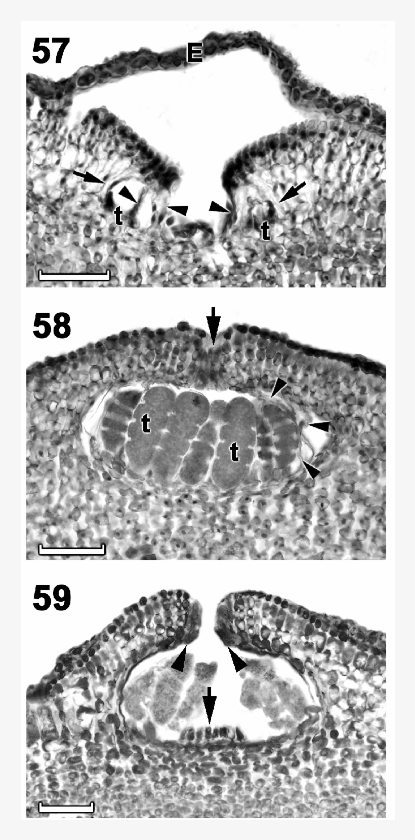Section Through A Young Tetrasporangial Conceptacle - Cartelas De Bingo Para Imprimir, transparent png #4503869