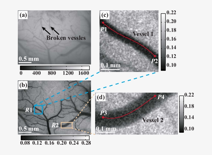 A White Light Image Of The Rat's Left Parietal Lobe - Rat Laser Speckle Contrast Imaging, transparent png #4536779