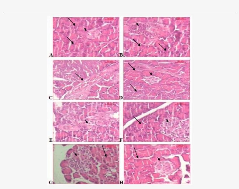Sections Of Pancreas Of A) Control Rat Shows Dense - Pancreas, transparent png #4545143