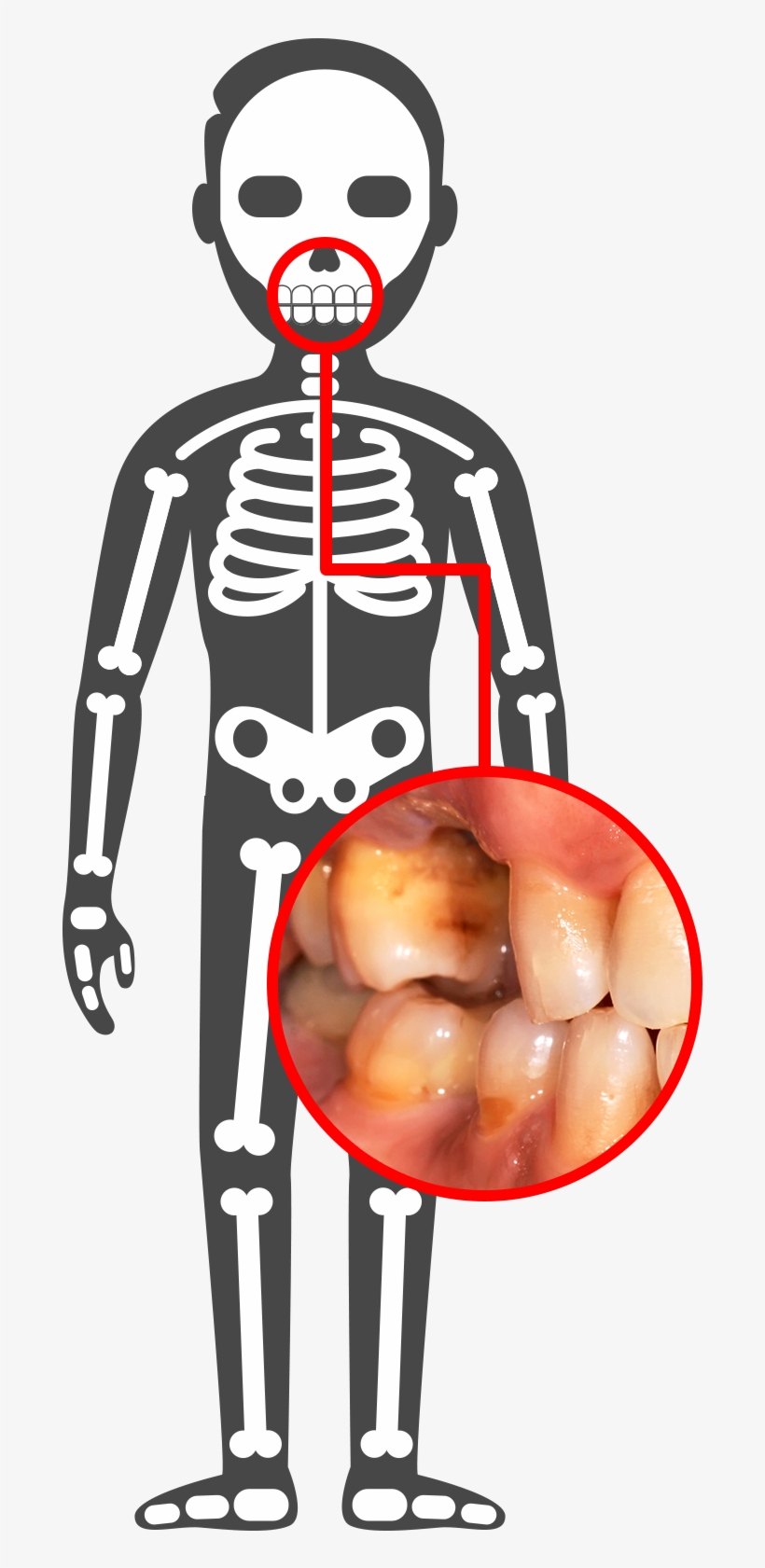 Pancreas - Human Body Illustration Png, transparent png #4546335