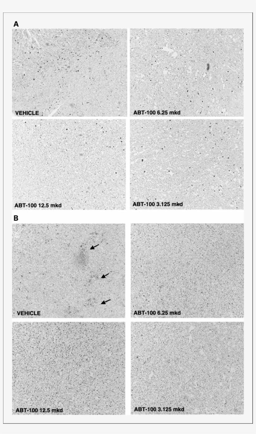 Abt 100 Affects Tumor Cell Proliferation And Apoptosis - Monochrome, transparent png #4556689