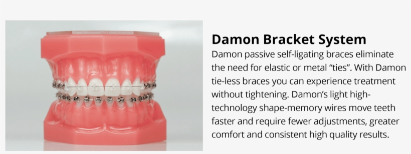 Previous - Fields Of Practice In Dentistry And Their Applications, transparent png #4570791
