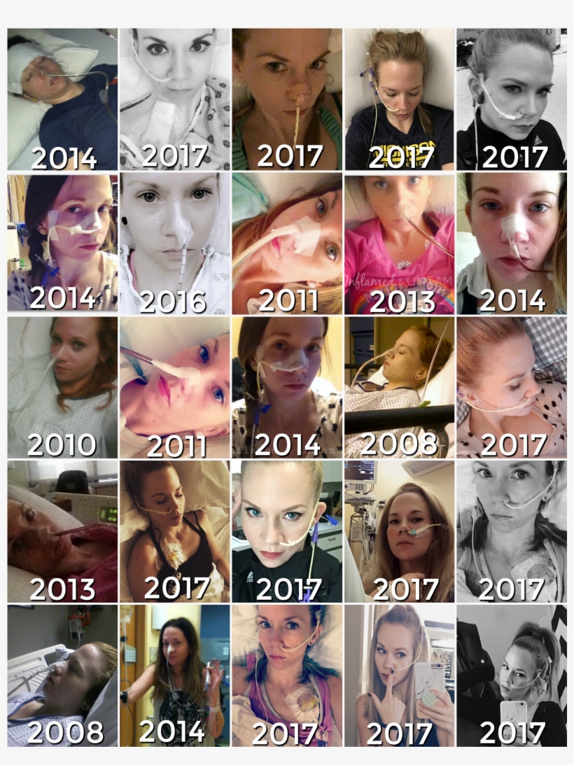 Picture 2 Ng Tube Blog - Blog, transparent png #4585999