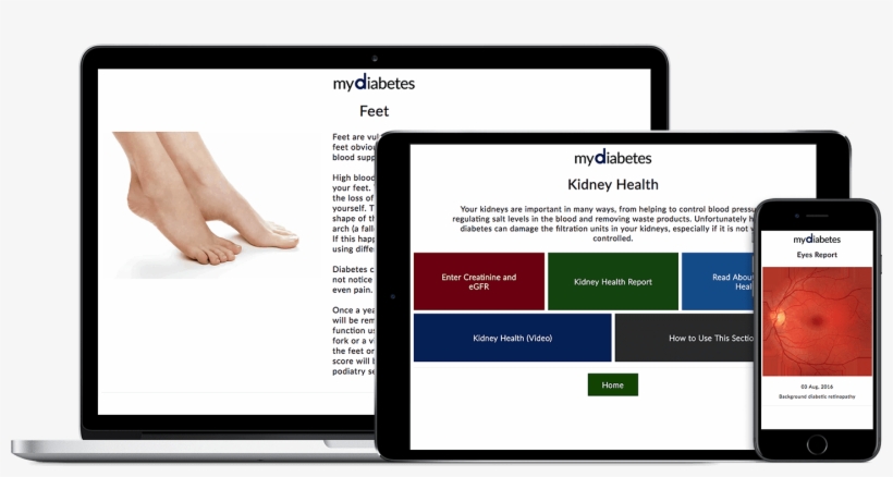 Eyes, Kidney And Foot Care - Copper Compression Arch Support - 2 Plantar Fasciitis, transparent png #4614027