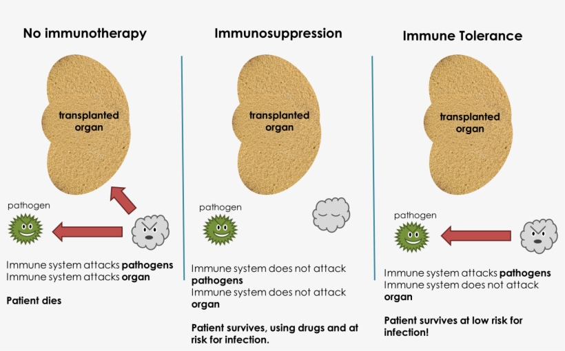 Immune Tolerance Def - Tree, transparent png #4623480