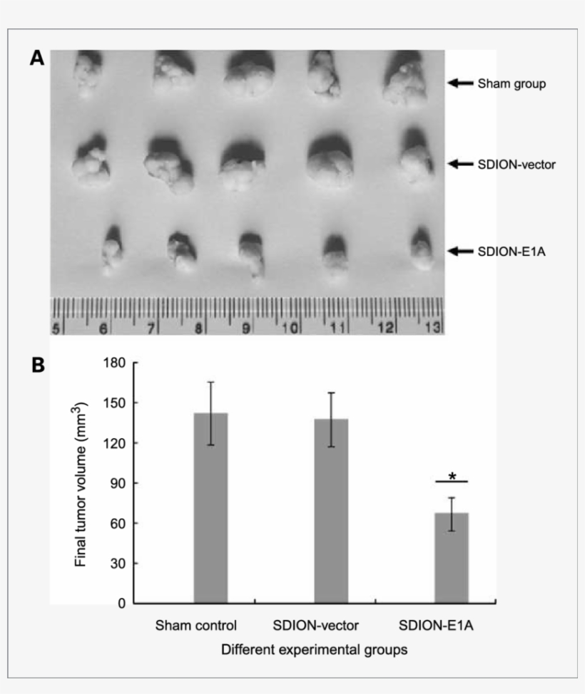 The Final Tumor Volume In Cervical Cancer Xenograft - Cancer, transparent png #4663052
