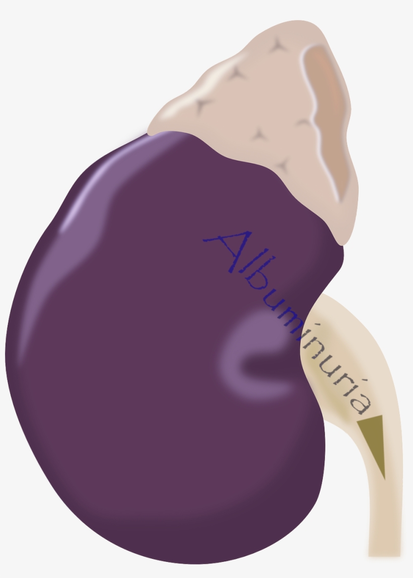 Jardiance Improves Urinary Protein Leak, transparent png #4665699