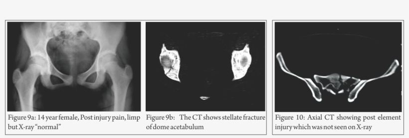 These Images Are Easy To Understand, Easy To Manipulate - Medical Imaging, transparent png #4679951