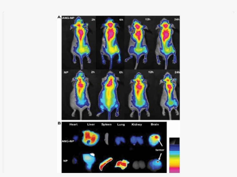 In Vivo Fluorescence Imaging Of Intracranial U87 Mg - U87, transparent png #474548