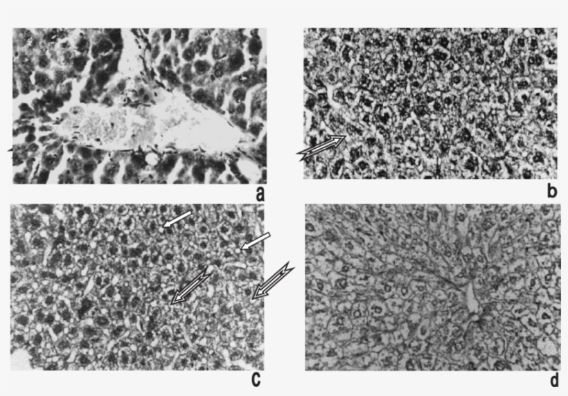Control Animal Liver Showing Central Vein And Hepatocytes - Monochrome, transparent png #4728161