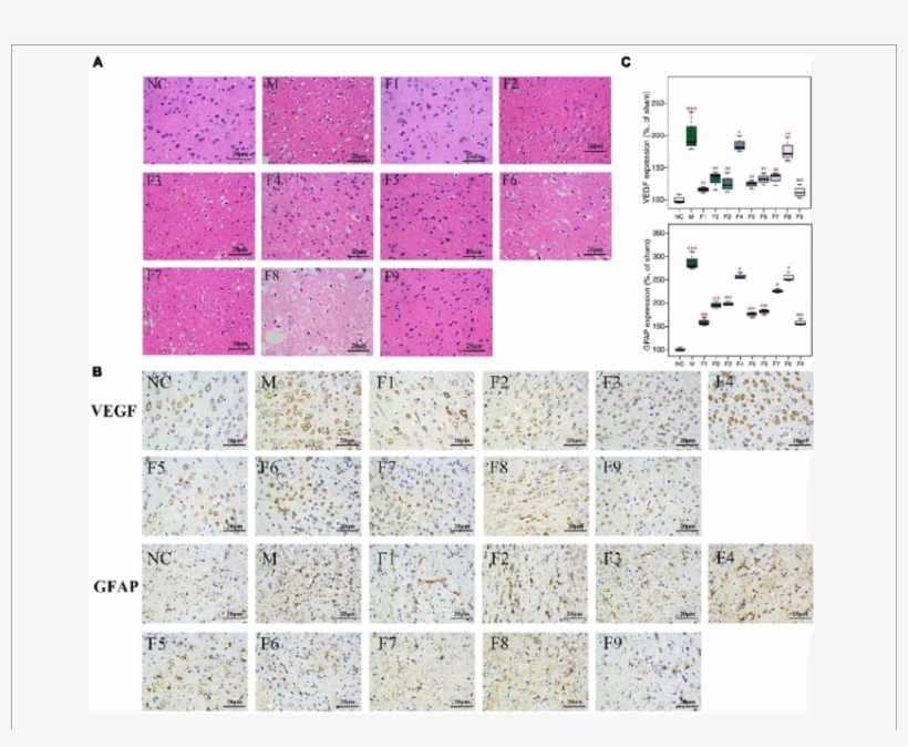 Histopathological Examination Of Brain Tissues By H&e - Art, transparent png #4740045