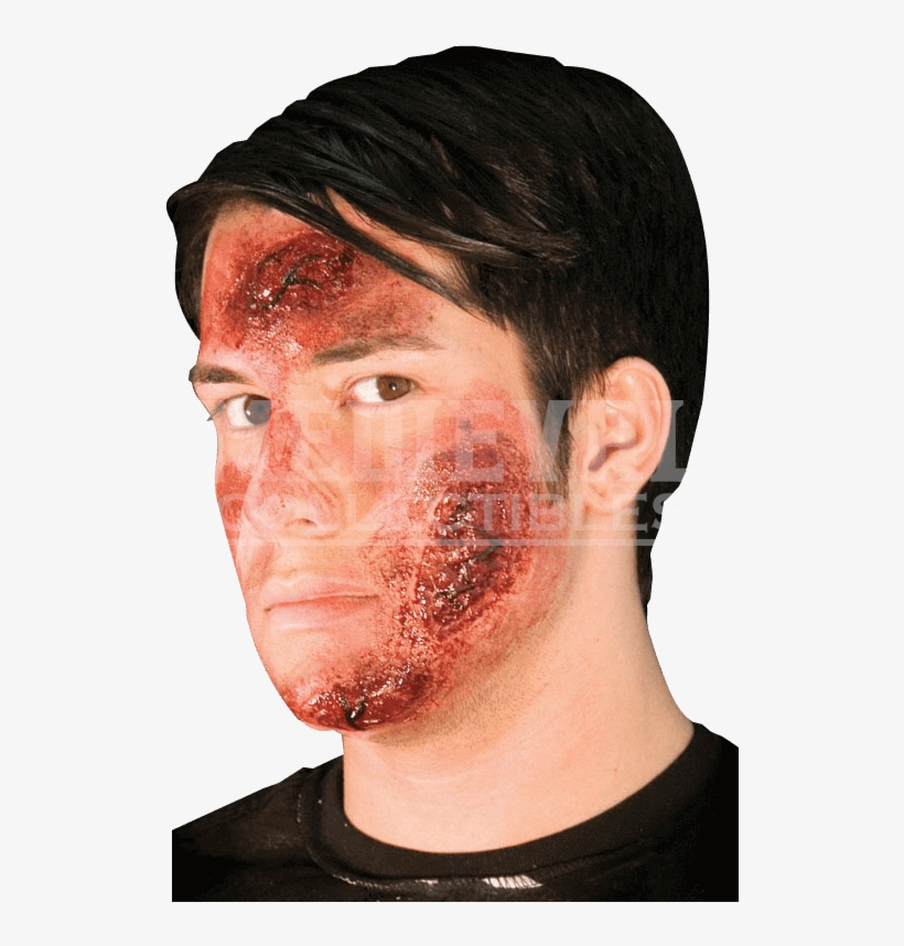 Burn Scar Png Graphic Freeuse Stock - Rotting Rash Latex Prosthesis, transparent png #4745902