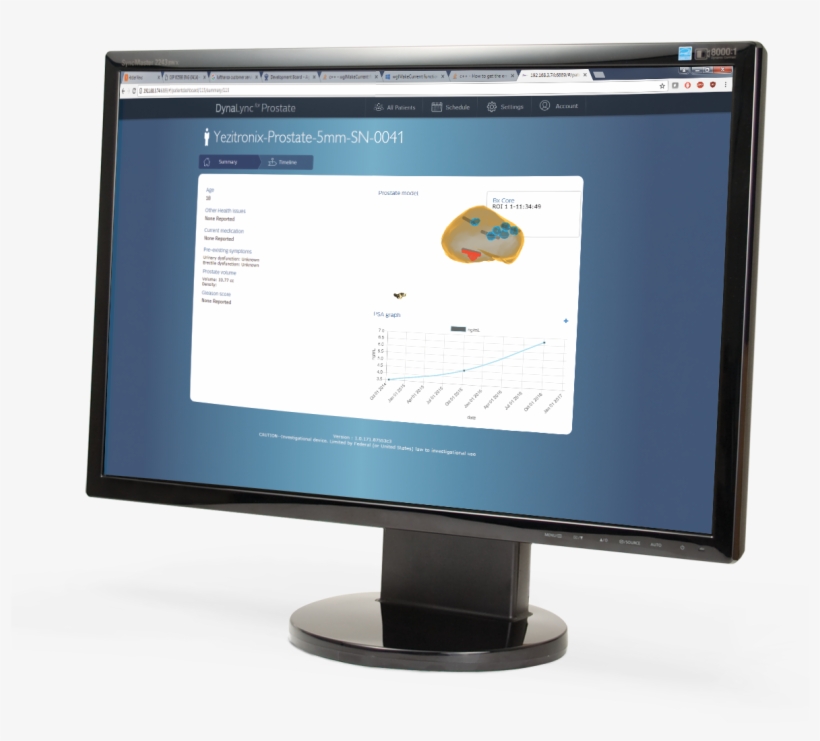 Dynalync Prostate Computer Screen - Computer Monitor, transparent png #4781147