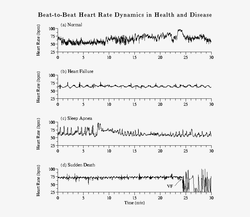 Heart Rate Time Series Of 30 Min From (a) A Healthy - Heart Failure Heart Beat, transparent png #4787821