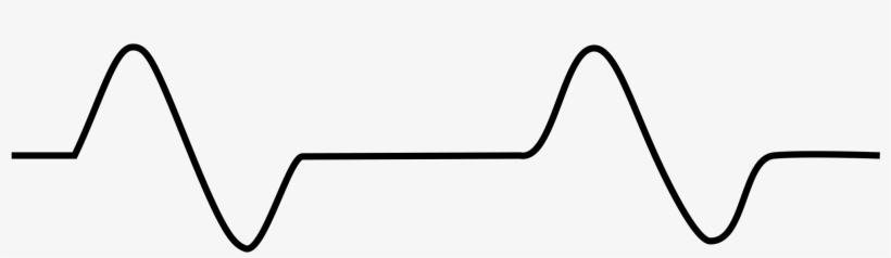 Open - Aktywność Elektryczna Bez Tętna Ekg, transparent png #4788255