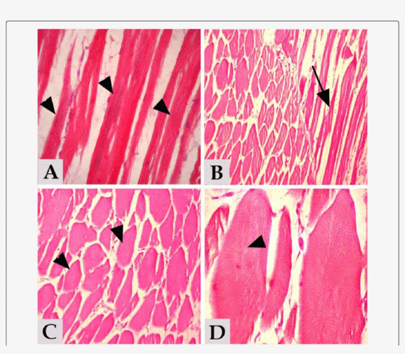 2 And 3 Showing Normal, Intact Skeletal Muscle With - Muscle, transparent png #4788325