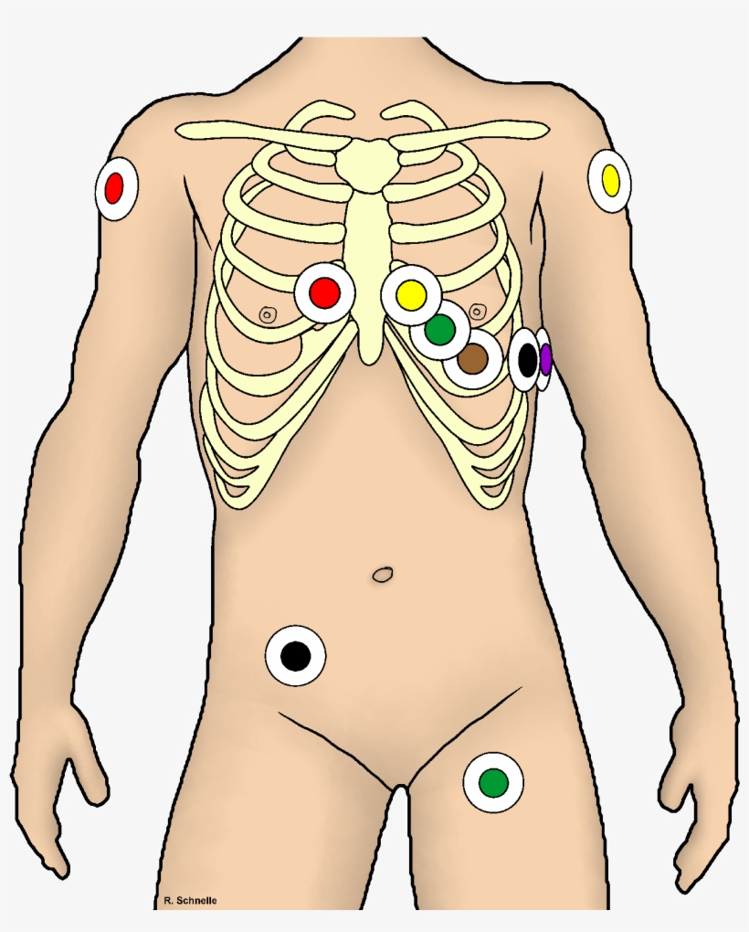 Ekg Ableitung Unter Rettungsdienst Bedingungen - 12 Kanal Ekg Kleben, transparent png #4788533