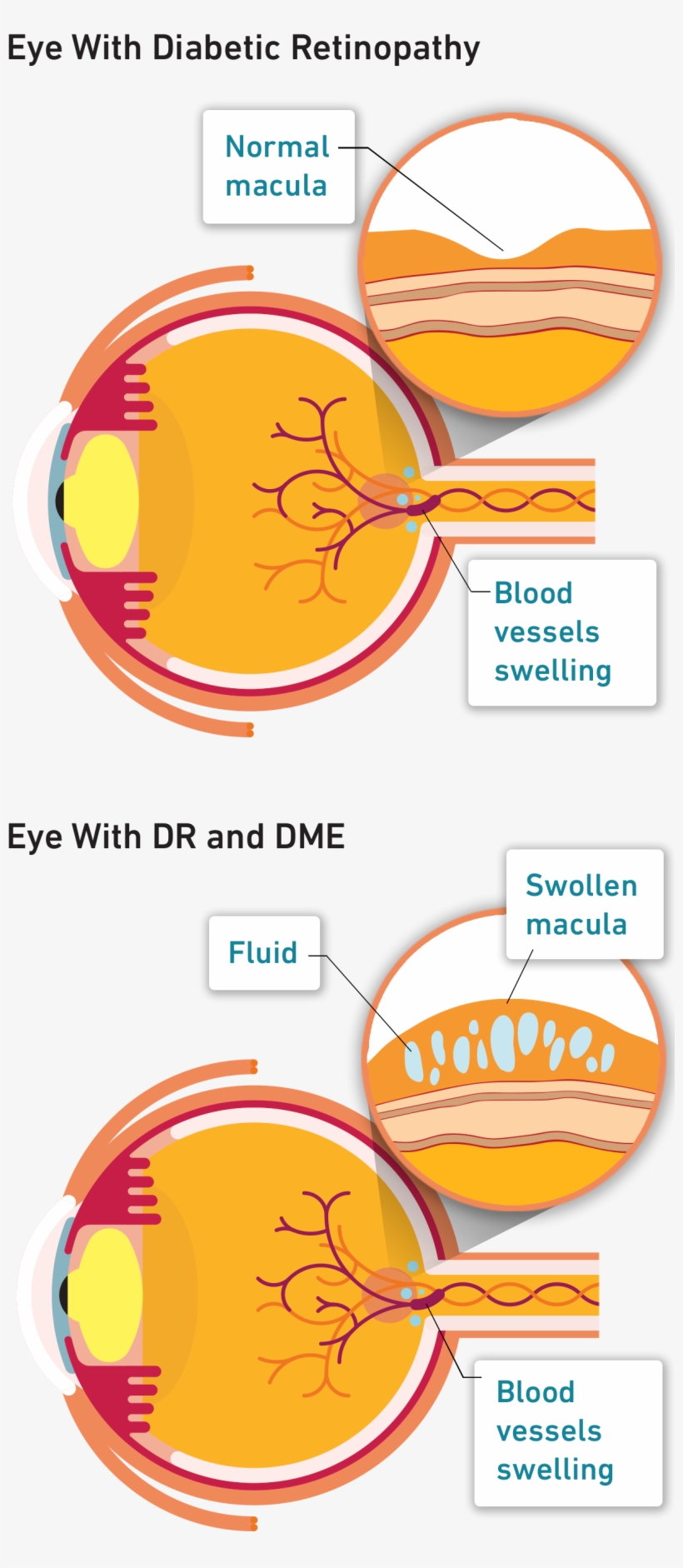 If You Have Diabetes And Are Experiencing Problems - Orange, transparent png #4791836