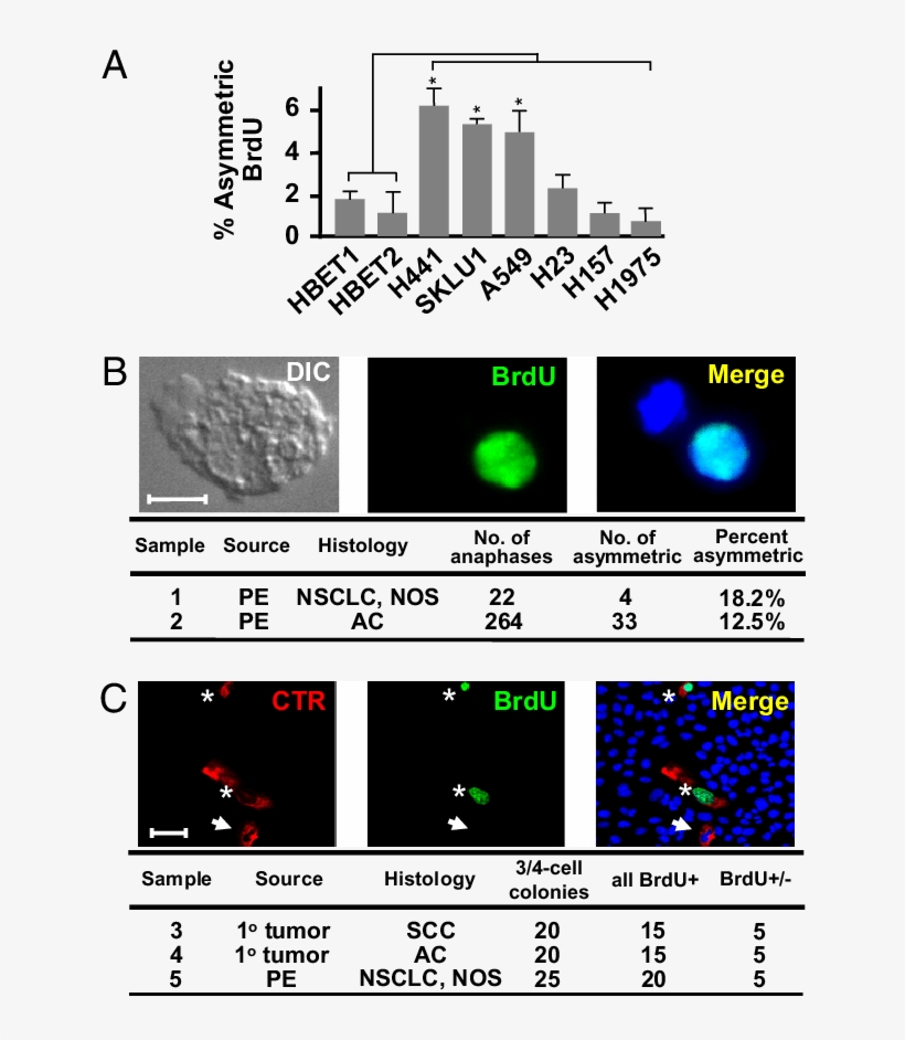 Template Dna Is Divided Asymmetrically In Several Human - Brdu And Asymmetric Division, transparent png #4820638