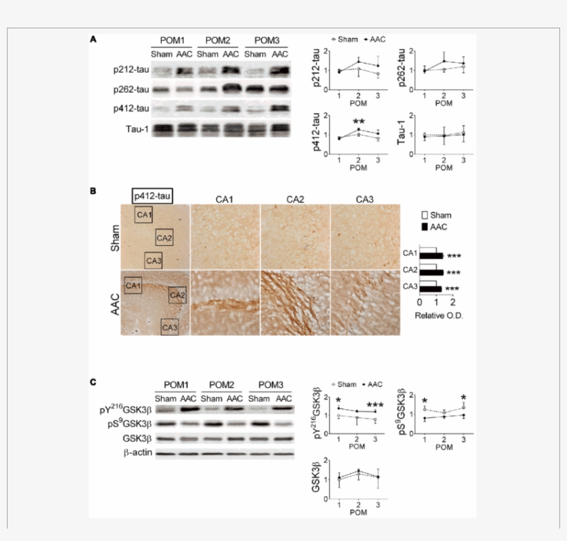 7 Month Old Pigs Were Given The Aac Or The Sham Operation, - Tau Protein, transparent png #4861423