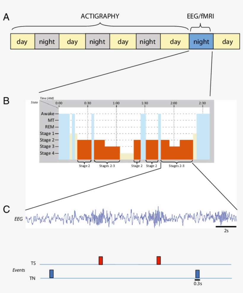 Volunteers Were Recorded With Eeg/fmri During The Experimental - Electroencephalography Functional Magnetic Resonance, transparent png #4872580